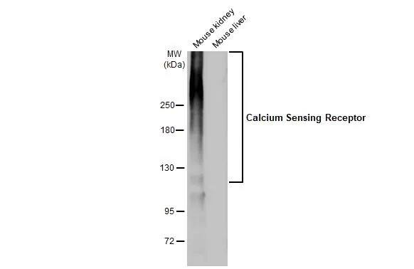 Calcium-sensing R/CaSR Antibody (HL2357) - Azide and BSA Free