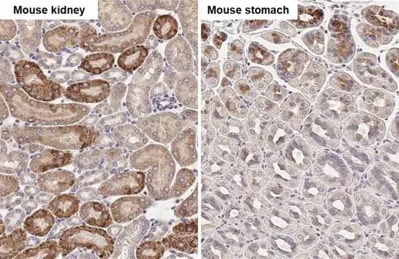 Calpain 5 Antibody (HL2432) - Azide and BSA Free