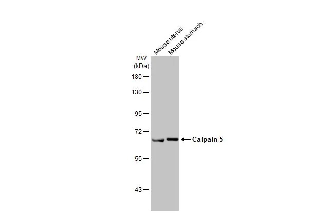 Calpain 5 Antibody (HL2432) - Azide and BSA Free