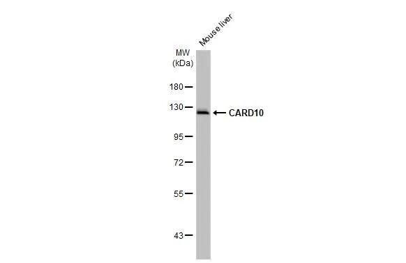 CARD10 Antibody (HL2261) - Azide and BSA Free