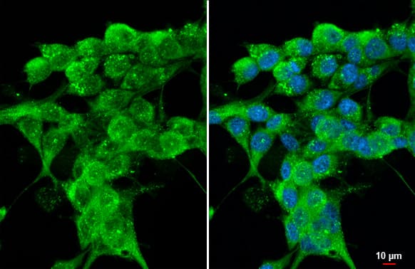 Cathepsin S Antibody (HL2302) - Azide and BSA Free