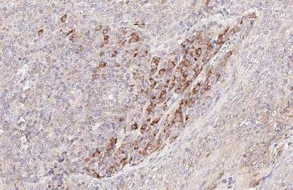 CCR4 Antibody (HL2481) - Azide and BSA Free