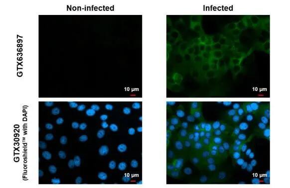 Chikungunya Virus nsp2 Antibody (HL1431) - Azide and BSA Free