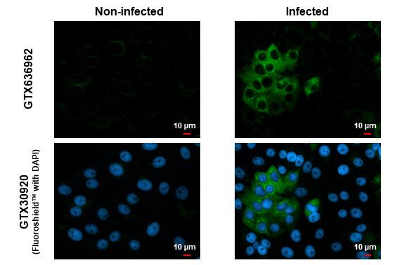 Chikungunya Virus nsp2 Antibody (HL1488) - Azide and BSA Free