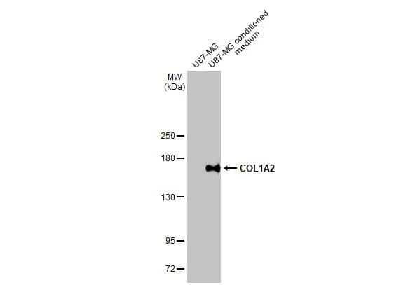 COL1A2 Antibody (HL2048) - Azide and BSA Free