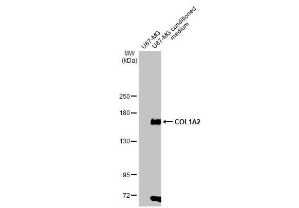 COL1A2 Antibody (HL2049) - Azide and BSA Free