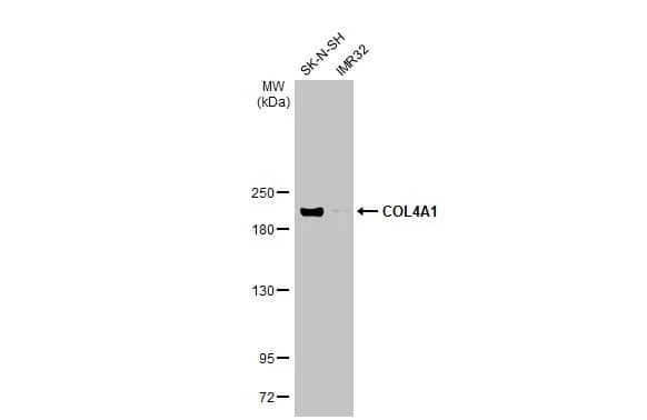 Collagen IV alpha 1 Antibody (HL1351) - Azide and BSA Free