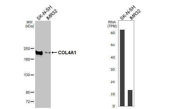 Collagen IV alpha 1 Antibody (HL1351) - Azide and BSA Free