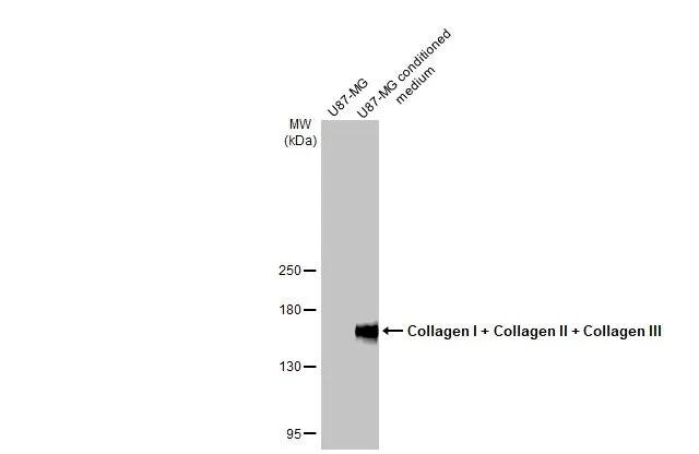Collagen I/II/III Antibody (HL2048 + HL1907) - Azide and BSA Free