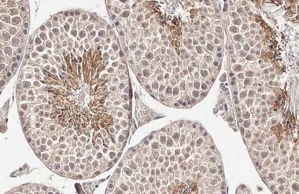 Collagen I/II/III Antibody (HL2048 + HL1907) - Azide and BSA Free