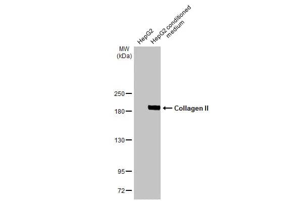 Collagen II Antibody (HL1772) - Azide and BSA Free