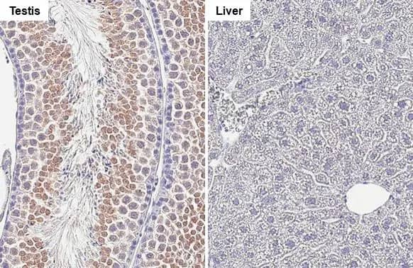 Collagen III alpha 1/COL3A1 Antibody (HL1906) - Azide and BSA Free