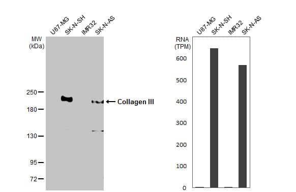 Collagen III alpha 1/COL3A1 Antibody (HL1906) - Azide and BSA Free