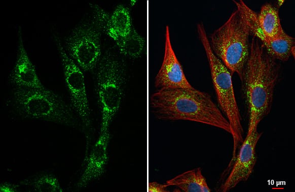 Collagen III alpha 1/COL3A1 Antibody (HL1906) - Azide and BSA Free