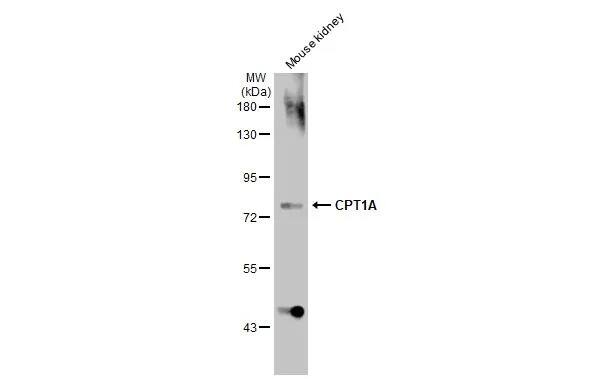 CPT1A Antibody (HL1164) - Azide and BSA Free