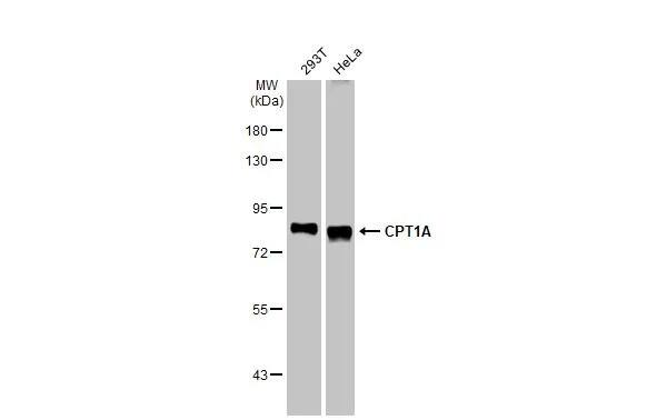 CPT1A Antibody (HL1164) - Azide and BSA Free