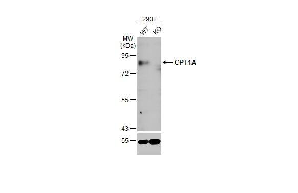 CPT1A Antibody (HL1164) - Azide and BSA Free