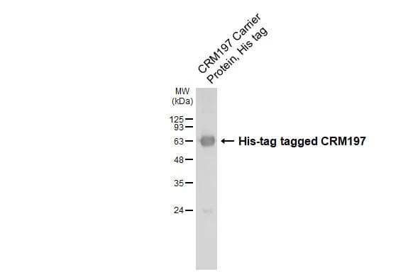 Diphtheria Toxin Antibody (HL1808) - CRM197 Mutant - Azide and BSA Free
