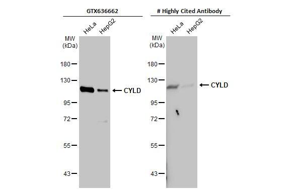 CYLD Antibody (HL1260) - Azide and BSA Free