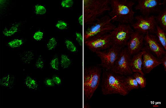 CYP24A1 Antibody (HL1783) - Azide and BSA Free