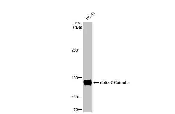 delta 2 Catenin Antibody (HL1629) - Azide and BSA Free