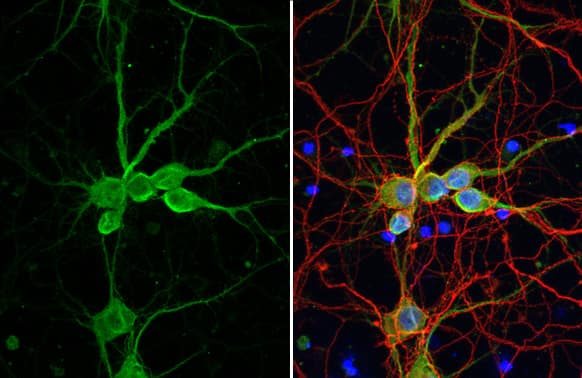 delta 2 Catenin Antibody (HL1629) - Azide and BSA Free