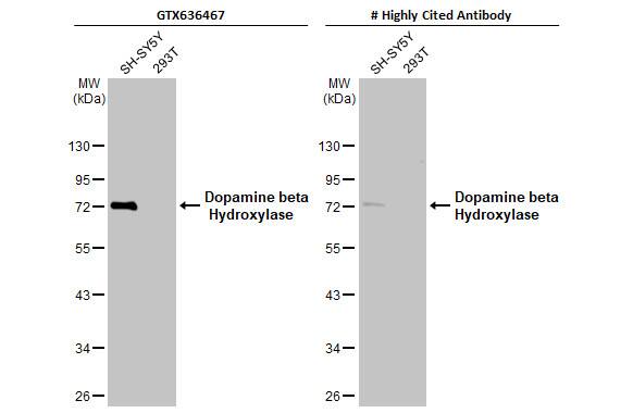 Dopamine beta-Hydroxylase Antibody (HL1163) - Azide and BSA Free