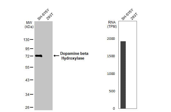 Dopamine beta-Hydroxylase Antibody (HL1163) - Azide and BSA Free