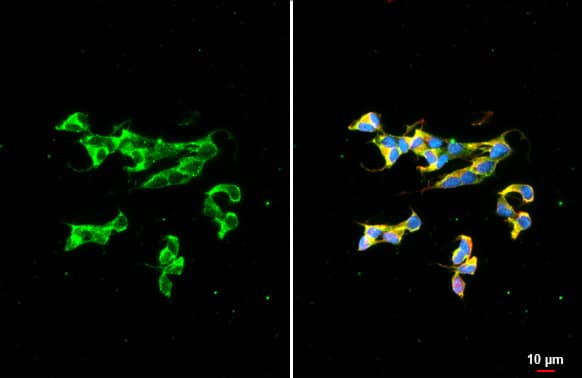 Dopamine beta-Hydroxylase Antibody (HL1163) - Azide and BSA Free