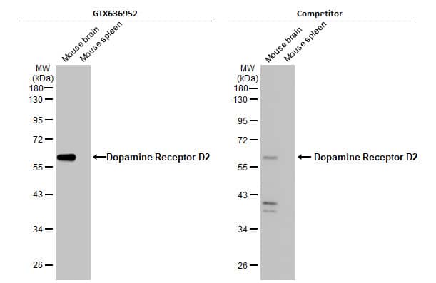 Dopamine D2R/DRD2 Antibody (HL1478) - Azide and BSA Free