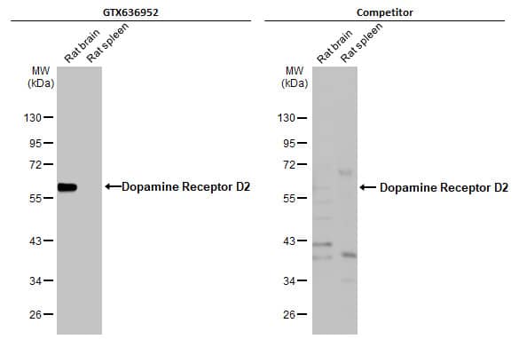 Dopamine D2R/DRD2 Antibody (HL1478) - Azide and BSA Free