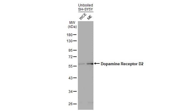 Dopamine D2R/DRD2 Antibody (HL1478) - Azide and BSA Free