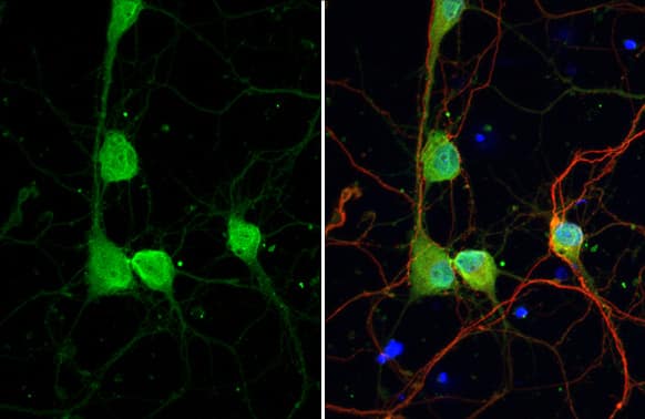 Dopamine D2R/DRD2 Antibody (HL1584) - Azide and BSA Free