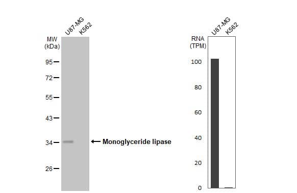 Monoglyceride Lipase Antibody (HL1938) - Azide and BSA Free