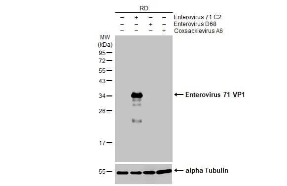 Enterovirus 71 VP1 Antibody (HL1928) - Azide and BSA Free