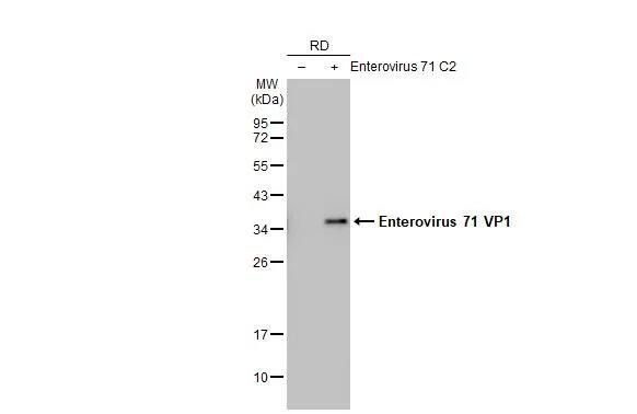 Enterovirus 71 VP1 Antibody (HL1929) - Azide and BSA Free