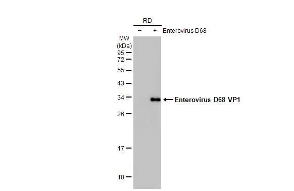 Enterovirus D68 VP1 Antibody (HL1997) - Azide and BSA Free