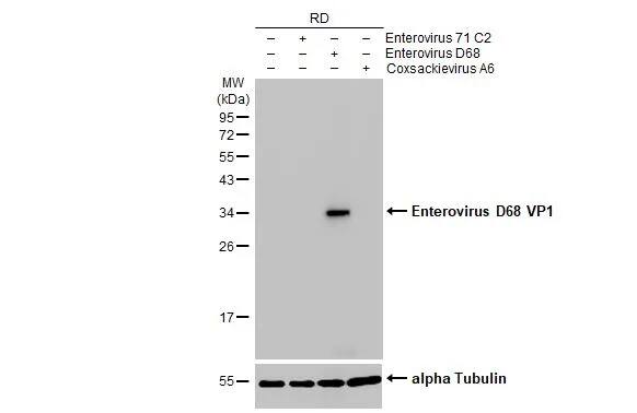 Enterovirus D68 VP1 Antibody (HL1997) - Azide and BSA Free