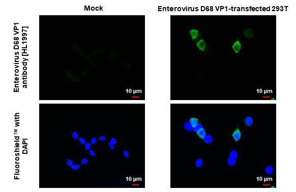 Enterovirus D68 VP1 Antibody (HL1997) - Azide and BSA Free
