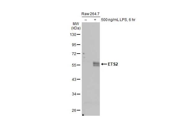 ETS2 Antibody (HL2259) - Azide and BSA Free
