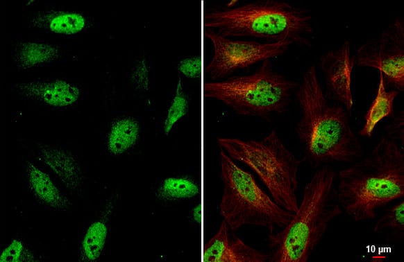 ETS2 Antibody (HL2259) - Azide and BSA Free