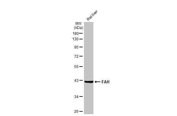 Fumarylacetoacetate hydrolase Antibody (HL1970) - Azide and BSA Free