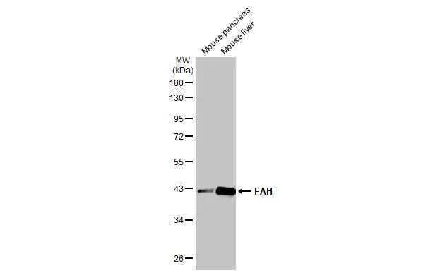 Fumarylacetoacetate hydrolase Antibody (HL1970) - Azide and BSA Free