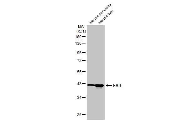 Fumarylacetoacetate hydrolase Antibody (HL1972) - Azide and BSA Free