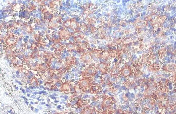 FCER1G Antibody (HL1418) - Azide and BSA Free