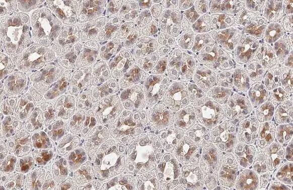 FN3K Antibody (HL2223) - Azide and BSA Free