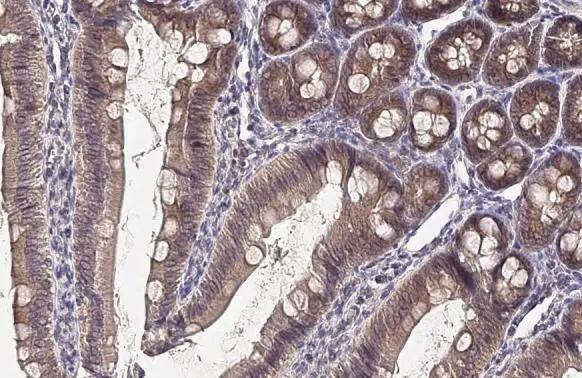 FN3K Antibody (HL2223) - Azide and BSA Free