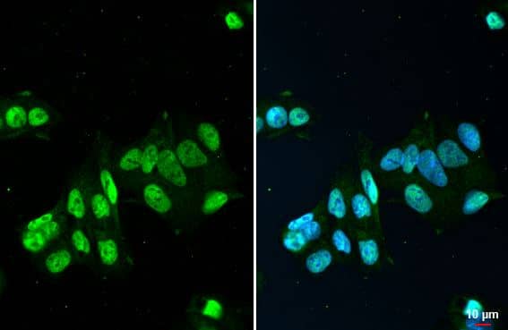FUS Antibody (HL2454) - Azide and BSA Free