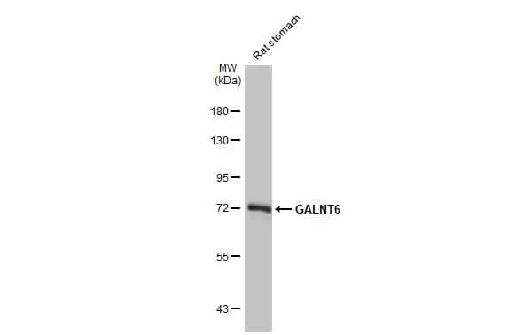 GALNT6 Antibody (HL2392) - Azide and BSA Free