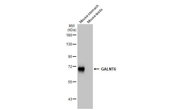 GALNT6 Antibody (HL2392) - Azide and BSA Free
